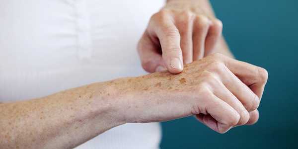 6 Health Tips to Prevent Common Skin Conditions